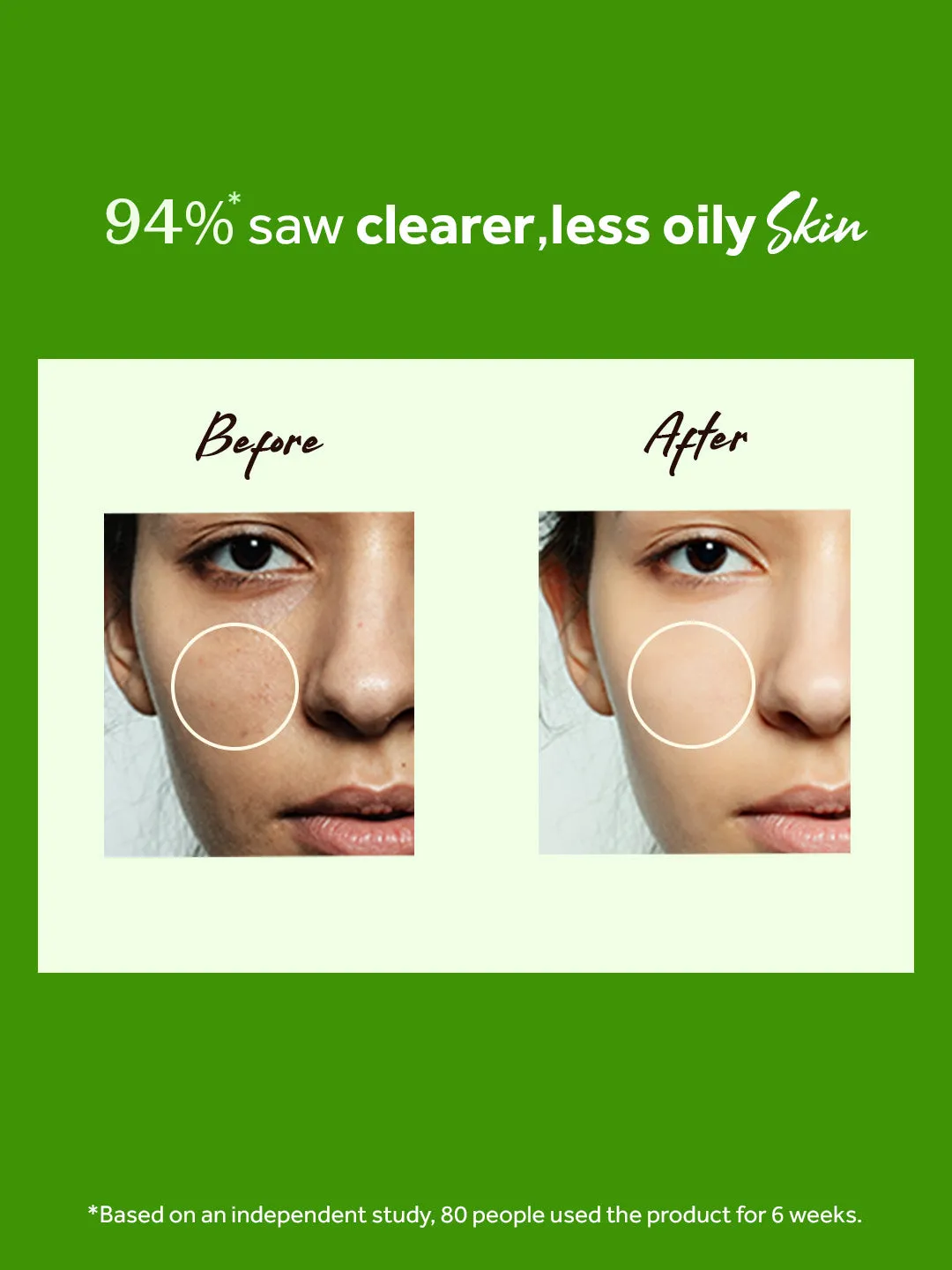 atulya Tea Tree  Anti acne Facial Mist Toner (Buy 7 Products & Get Rs.700 Off)